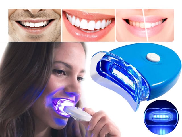 sbiancamento denti laser